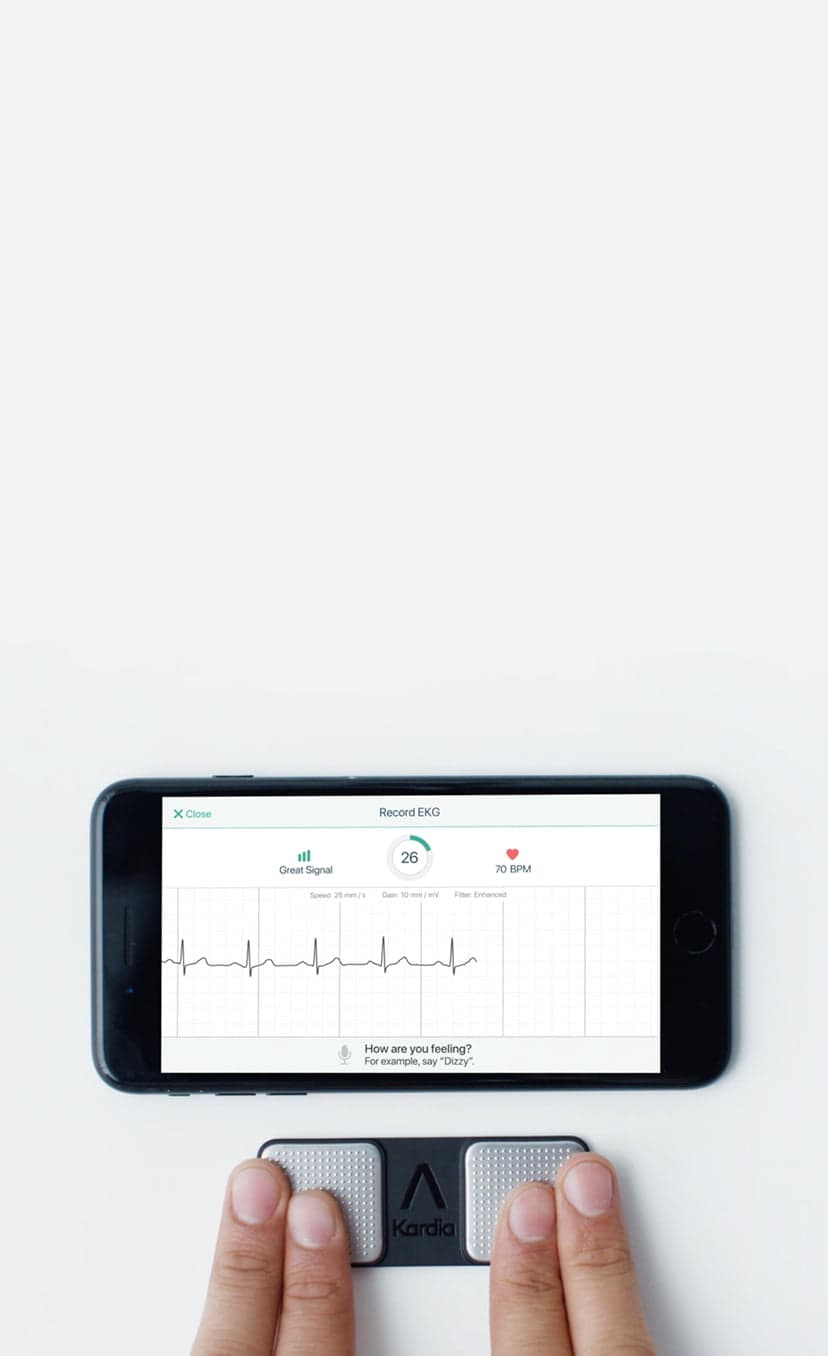 kardia mobile