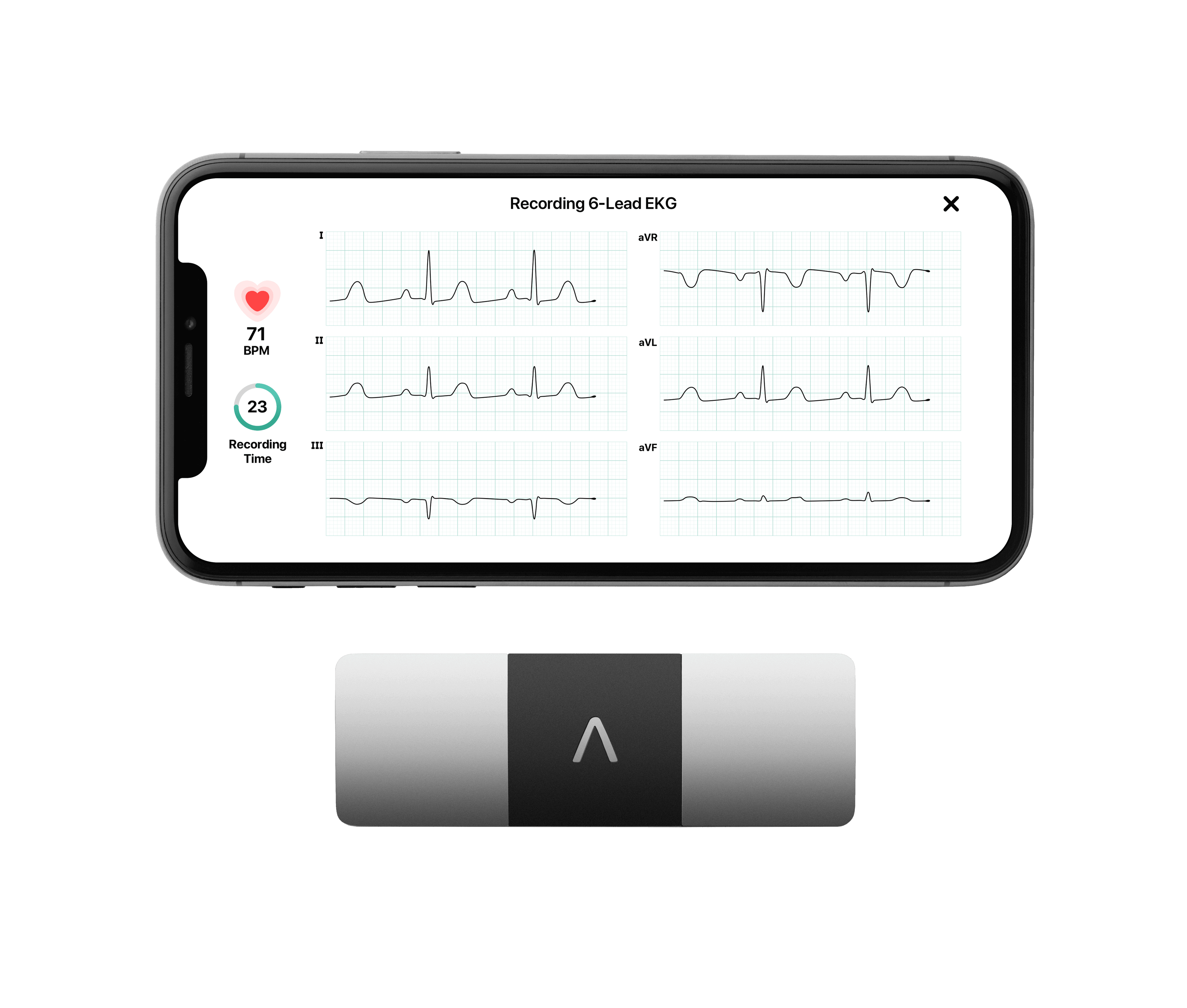 Kardia Device
