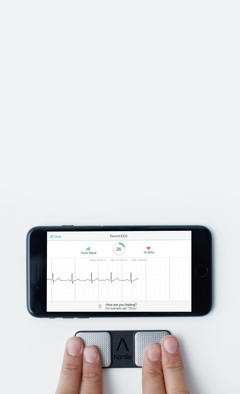 kardia mobile